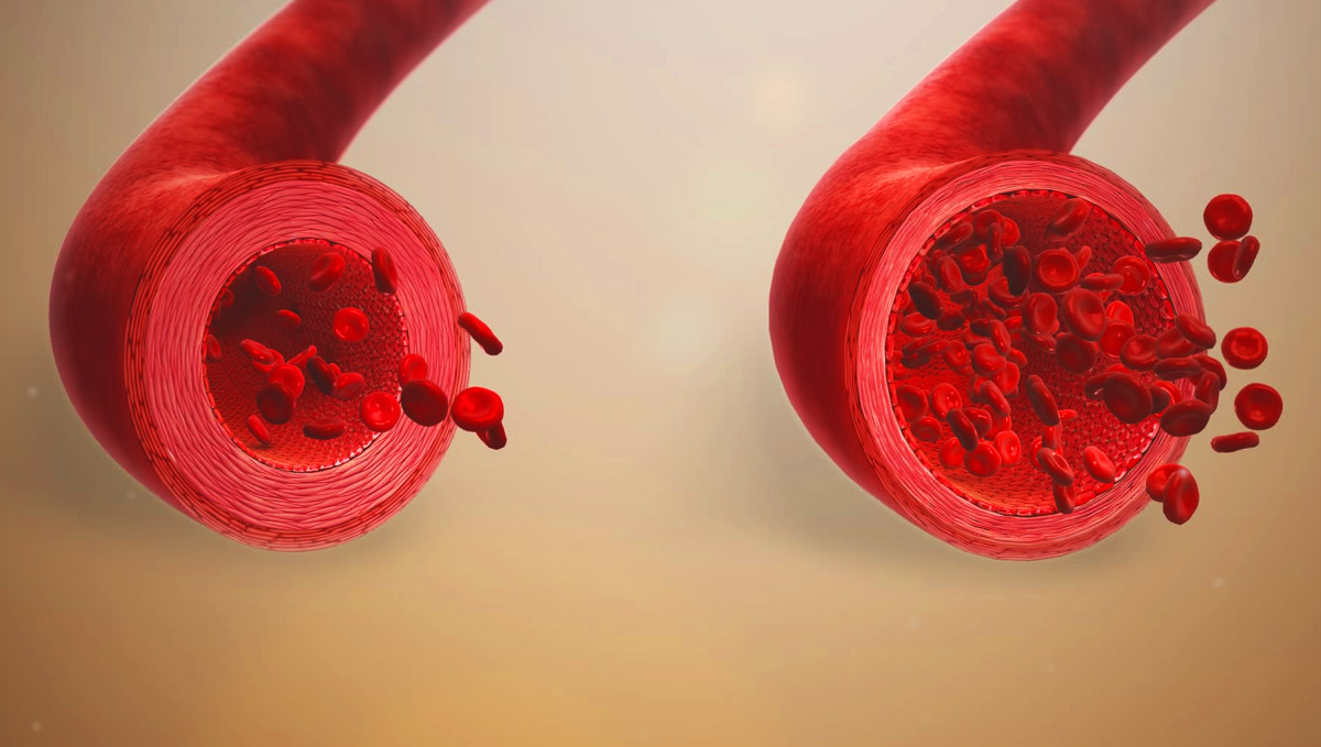 Vasodilation illustrative image.