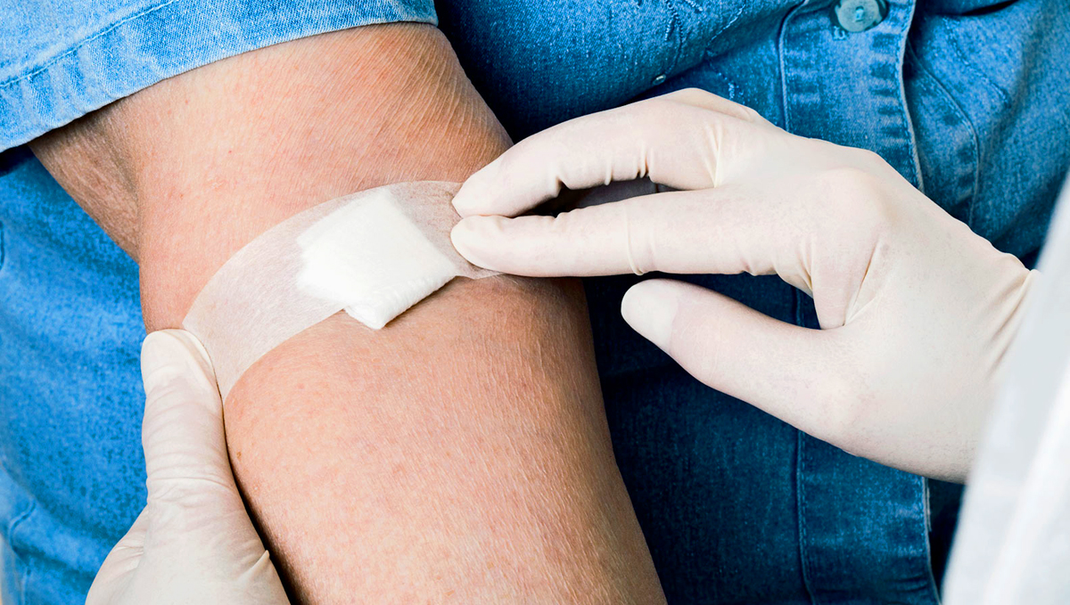 Blood tests are performed to diagnose cannabis allergy.