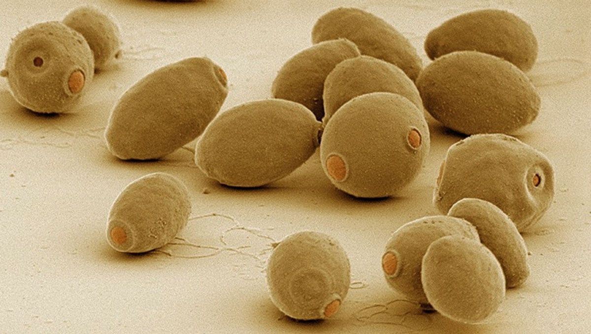 Brewing Cannabis With Hacked Beer Yeast: Scientists turn yeast into cannabinoids.