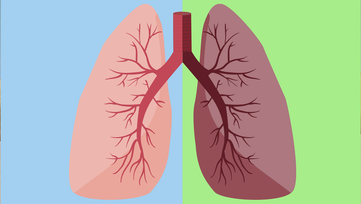 Lungs' health differences between smoking and vaping Lungs' health differences between smoking and vaping