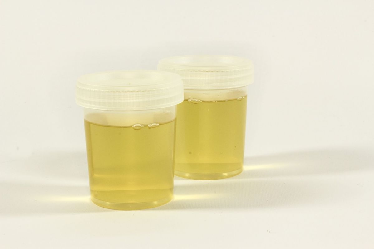 urine test