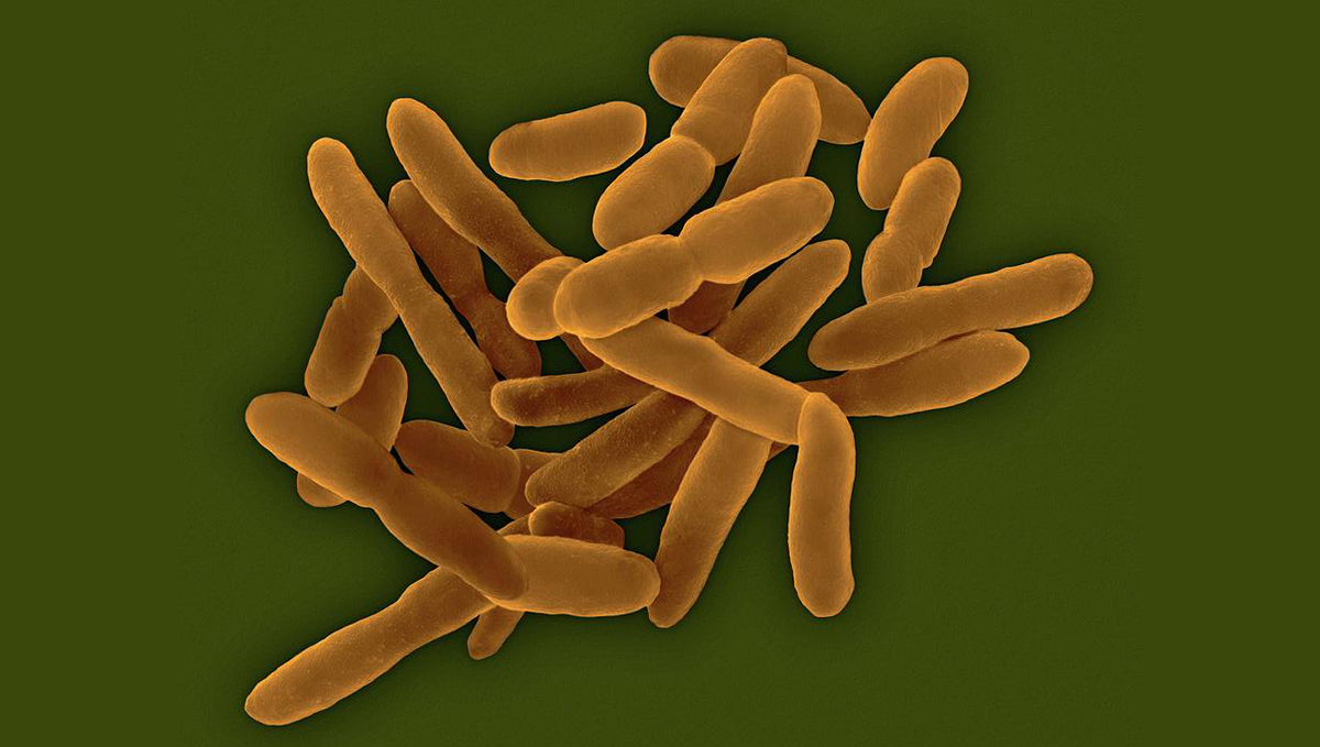 Benefits of microorganisms: anthrobacter Benefits of microorganisms: anthrobacter